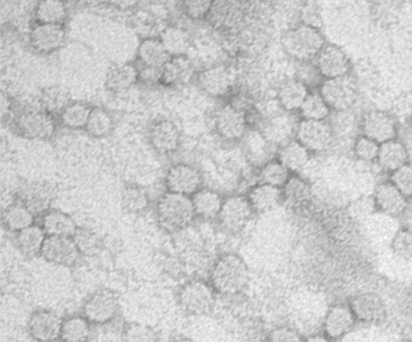 Figure 1: Electron micrograph of Hepatitis B sHBsAg particles produced with LEXSY. From Czarnota et al. (2016).